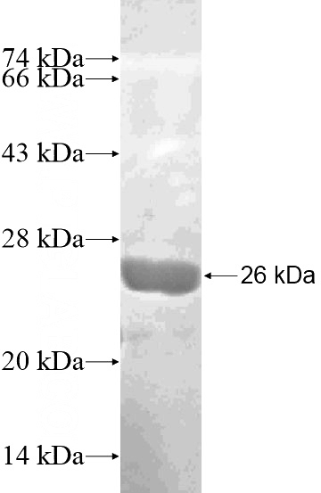 Recombinant Human CD1E SDS-PAGE