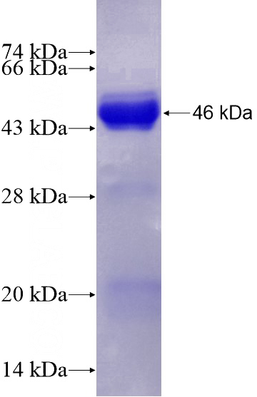 Recombinant Human URG4 SDS-PAGE