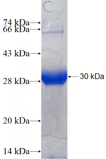 Recombinant Human PLA2G4F SDS-PAGE