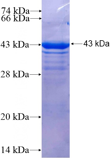 Recombinant Human VTA1 SDS-PAGE