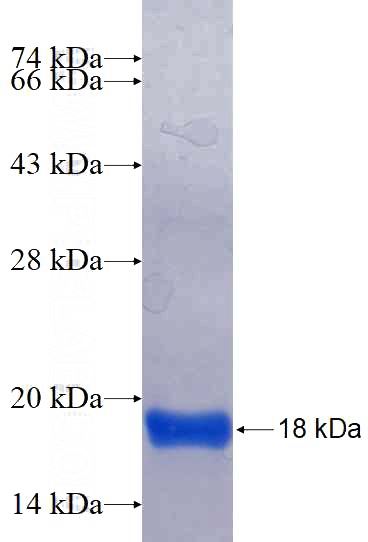 Recombinant Human CSAD SDS-PAGE