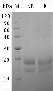 Human INSL3/RLF/RLNL (His tag) recombinant protein