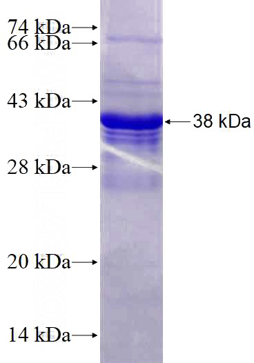 Recombinant Human SLD5 SDS-PAGE