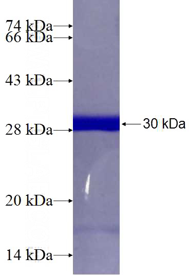 Recombinant Human KIAA1524 SDS-PAGE