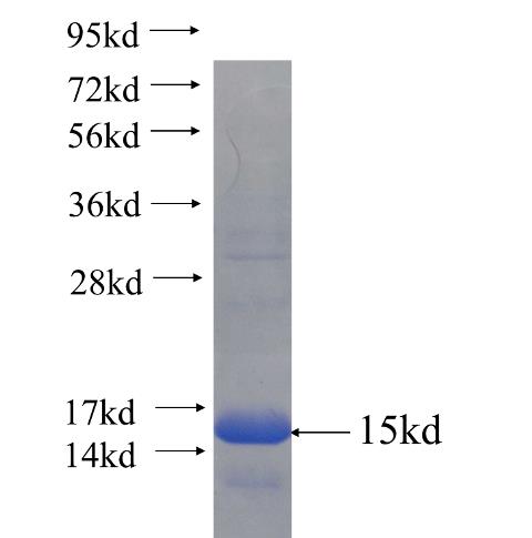 Recombinant human GJB6 SDS-PAGE