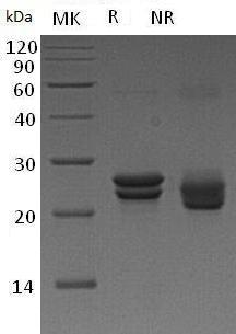 Human CDO1 (His tag) recombinant protein