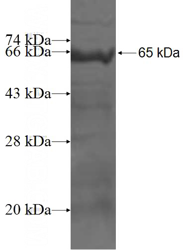 Recombinant Human RINT1 SDS-PAGE
