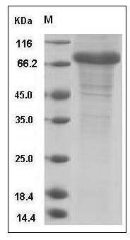 Human Follistatin / FST Protein (Fc Tag) SDS-PAGE