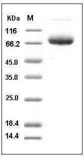 Mouse PD-L1 / B7-H1 / CD274 Protein (His & Fc Tag) SDS-PAGE