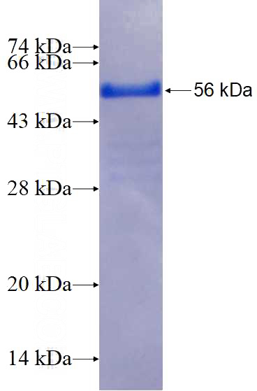 Recombinant Human MAGEB1 SDS-PAGE