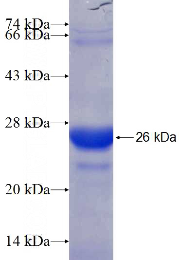 Recombinant Human ARL3 SDS-PAGE