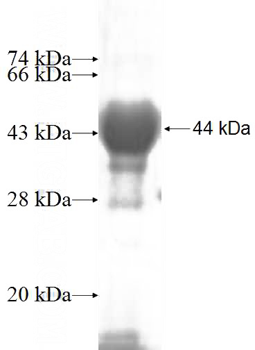 Recombinant Human LDHD SDS-PAGE