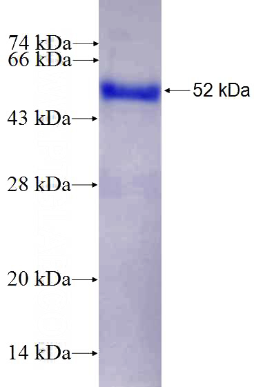 Recombinant Human UTRN SDS-PAGE