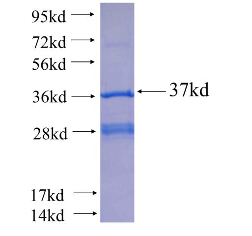 Recombinant human SLC22A7 SDS-PAGE