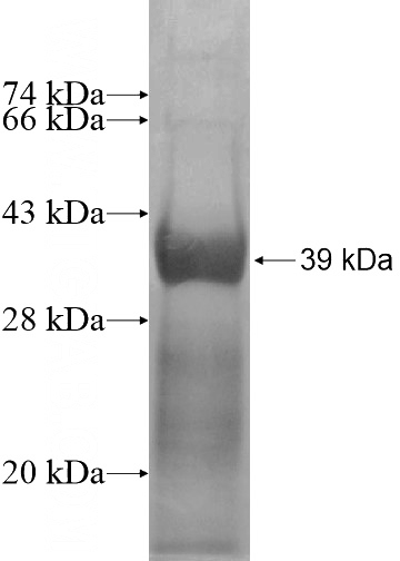 Recombinant Human OPHN1 SDS-PAGE