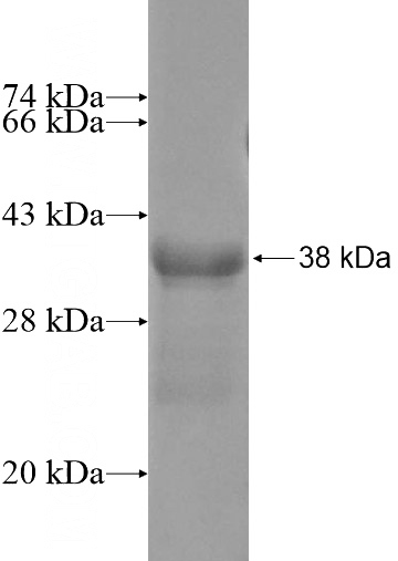 Recombinant Human BTBD10 SDS-PAGE