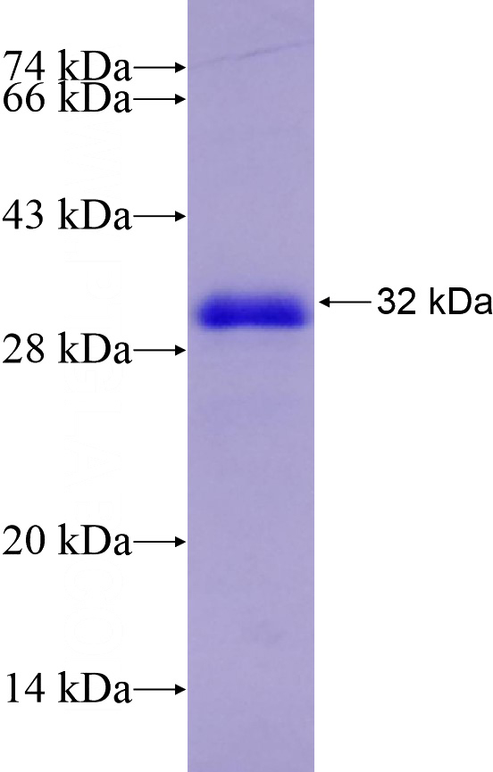 Recombinant Human HSD3B2 SDS-PAGE
