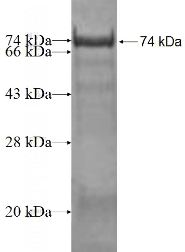 Recombinant Human NCOA4 SDS-PAGE