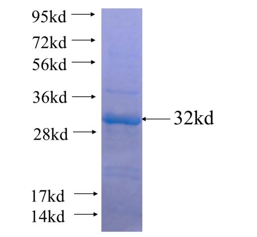 Recombinant human SMAD1 SDS-PAGE