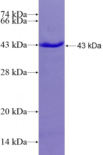 Recombinant Human TSC2 SDS-PAGE