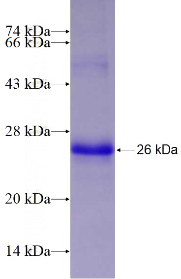 Recombinant Human DDIT4L SDS-PAGE
