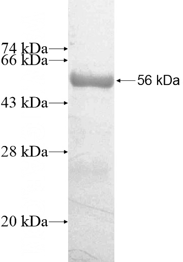 Recombinant Human OLAH SDS-PAGE