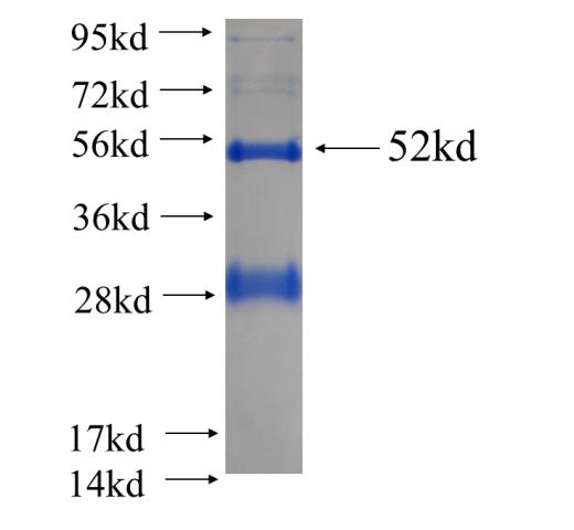 Recombinant human MSRA SDS-PAGE