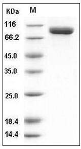 Mouse CD10 / Neprilysin / MME Protein (His Tag) SDS-PAGE