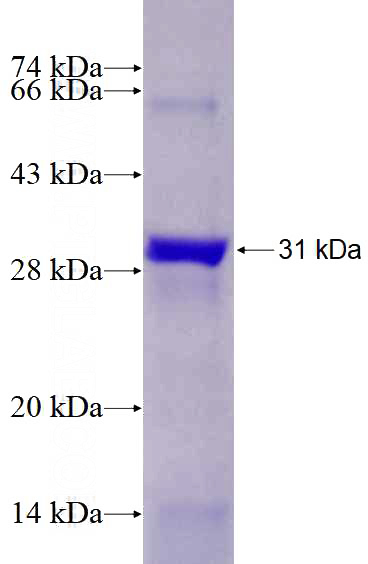 Recombinant Human ANGPTL3 SDS-PAGE
