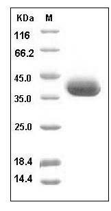 Human sFRP1 / SARP2 Protein (His Tag) SDS-PAGE