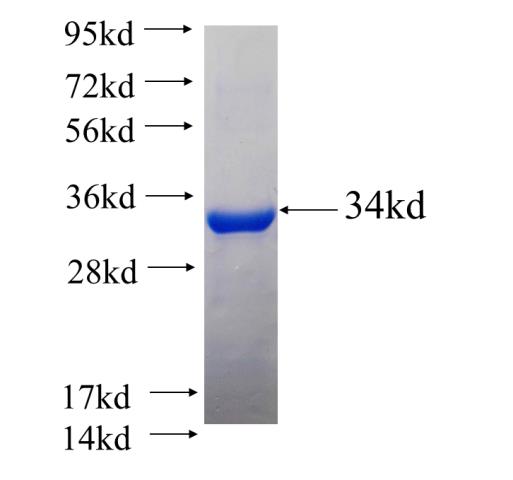 Recombinant Arabidopsis thaliana GLX2-5 SDS-PAGE
