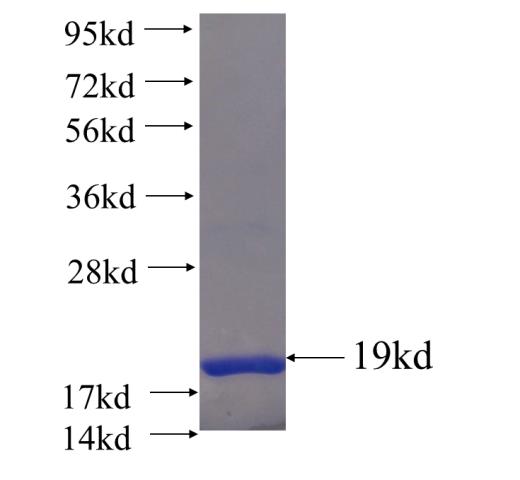 Recombinant human IFIT1 SDS-PAGE