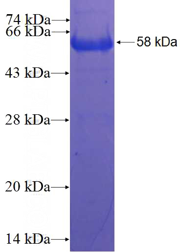 Recombinant Human BCAS1 SDS-PAGE