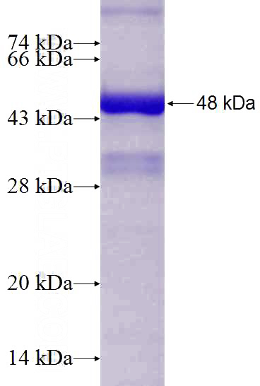 Recombinant Human ACTA1 SDS-PAGE