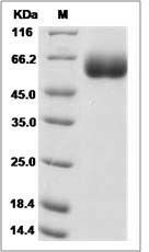 Rat Hemopexin / HPX Protein (His Tag)