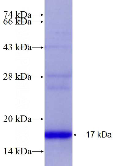 Recombinant Human TUBG2 SDS-PAGE
