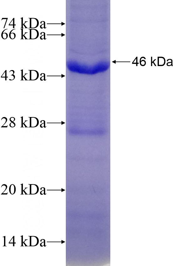 Recombinant Human ASAH1 SDS-PAGE