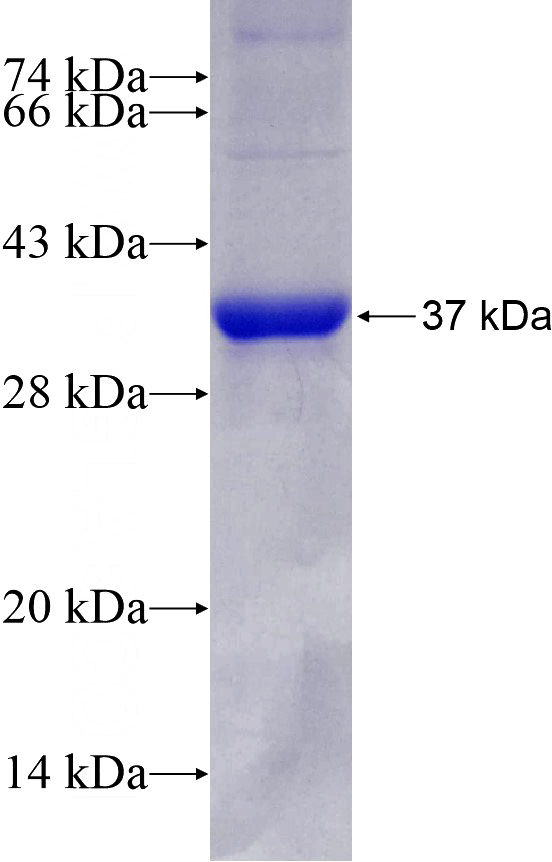 Recombinant Human TBXAS1 SDS-PAGE