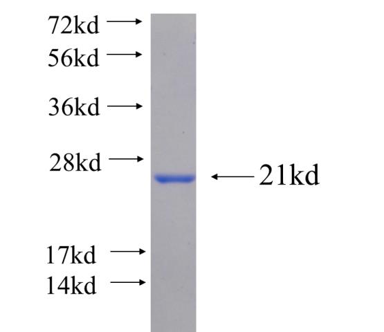 Recombinant human MYT1 SDS-PAGE