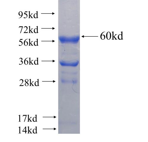 Recombinant human MGLL(Full length) SDS-PAGE