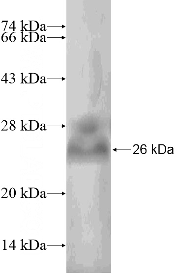 Recombinant Human HDAC9 SDS-PAGE