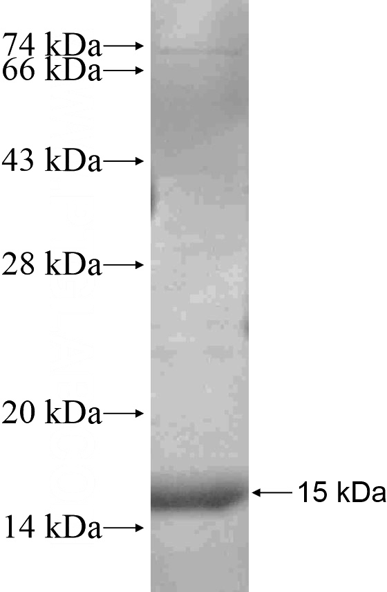 Recombinant Human SMARCA4 SDS-PAGE