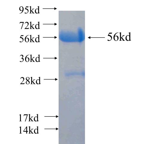 Recombinant human EXOSC8(Full length) SDS-PAGE