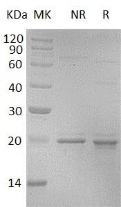 Human CDKN1A/CAP20/CDKN1/CIP1 (His tag) recombinant protein