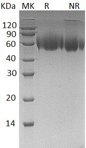Human PVR/PVS (His tag) recombinant protein