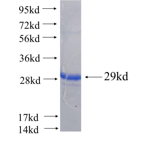 Recombinant human RAB9B(Full length) SDS-PAGE