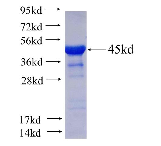 Recombinant human CTTNBP2 SDS-PAGE
