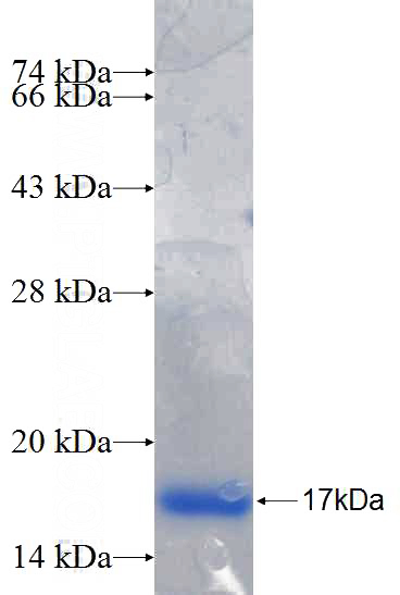 Recombinant Human MSI1 SDS-PAGE