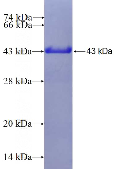 Recombinant Human RPS13 SDS-PAGE