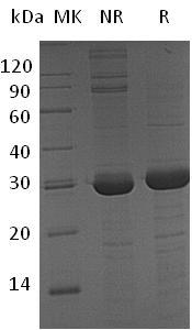 Human BCAS2/DAM1 (His tag) recombinant protein